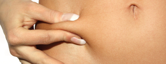 Fettabsaugung (Liposuktion) - Fettpolster schmelzen lassen